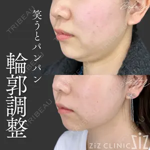 ziz CLINIC 村岡 史子医師の症例