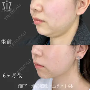 ziz CLINIC 村岡 史子医師の症例