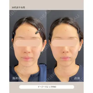 自由が丘ウェルエイジングビューティークリニック 福田 知佐子医師の症例