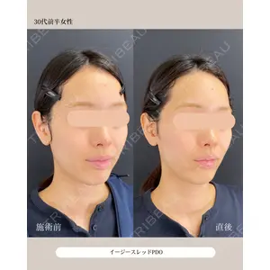 自由が丘ウェルエイジングビューティークリニック 福田 知佐子医師の症例