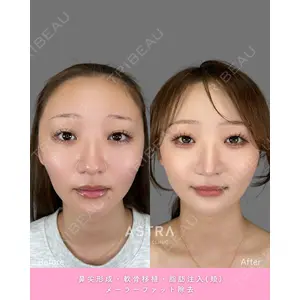 ASTRA BEAUTY CLINIC 河口 はるか医師の症例
