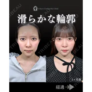 東京シンデレラ美容外科 池袋院 石井 達也医師の症例