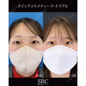 湘南美容クリニック 神戸三宮院 中川 卓医師の症例