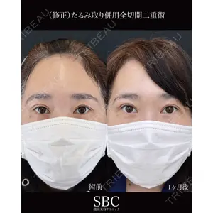 湘南美容クリニック 神戸三宮院 中川 卓医師の症例