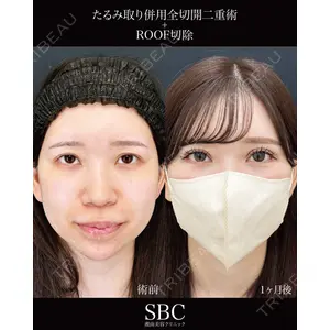 湘南美容クリニック 神戸三宮院 中川 卓医師の症例