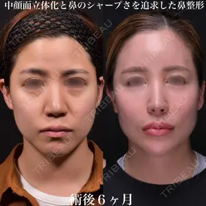 Zetith Beauty Clinic 銀座院 鉄 鑠医師の症例