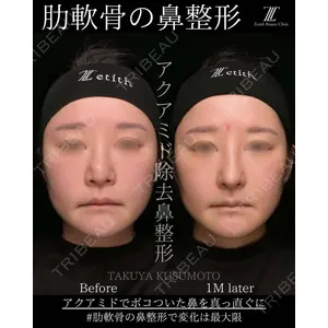 Zetith Beauty Clinic 大阪心斎橋院 楠本 拓哉医師の症例