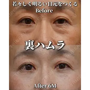 Zetith Beauty Clinic 銀座院 橘　澄医師の症例