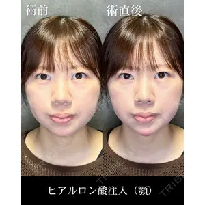 HAAB CLINIC 福岡院 北村 可恋医師の症例
