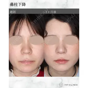 千葉美容外科アイビークリニックの症例