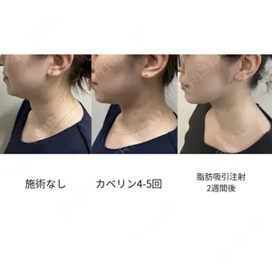 おおたかの森ビューティークリニックthe artの症例