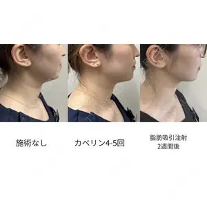 おおたかの森ビューティークリニックthe artの症例
