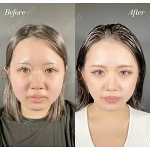 R Beauty CLINIC 名古屋院 木村 尚大医師の症例