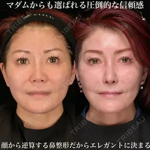 Zetith Beauty Clinic 銀座院 鉄 鑠医師の症例