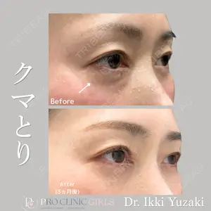 PRO CLINIC プロクリニック 銀座院 柚﨑 一輝医師の症例