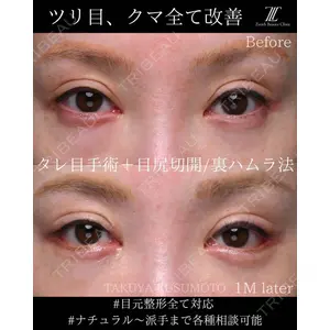 Zetith Beauty Clinic 大阪心斎橋院 楠本 拓哉医師の症例