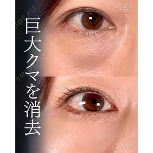 神戸美容外科 ネビュラクリニック 岩﨑 雅医師の症例