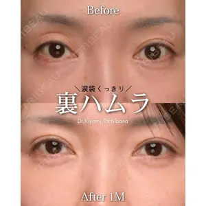 Zetith Beauty Clinic 銀座院 橘　澄医師の症例