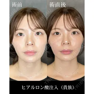 HAAB CLINIC 福岡院 米谷 拓朗医師の症例