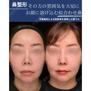 Zetith Beauty Clinic 銀座院 守屋 亜妃医師の症例
