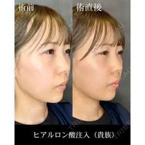 HAAB CLINIC 福岡院 米谷 拓朗医師の症例