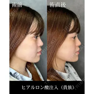 HAAB CLINIC 福岡院 米谷 拓朗医師の症例