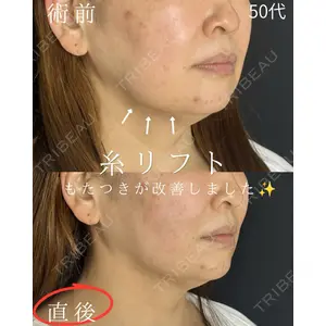 ルラ美容クリニック 仙台院 / ルラスキンクリニック 仙台院 橋本 英樹医師の症例