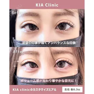 KIA CLINIC 心斎橋院 雲山　盛秀医師の症例