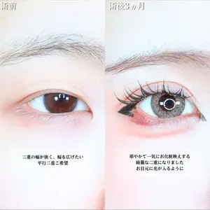 アリエル美容クリニック 水戸院 天白 典秀医師の症例