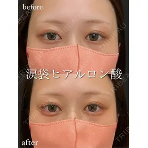 アデル美容クリニックの症例
