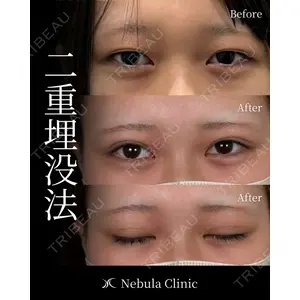 愛知春日井美容外科ネビュラクリニック 都築 諒医師の症例