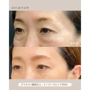 自由が丘ウェルエイジングビューティークリニック 福田 知佐子医師の症例