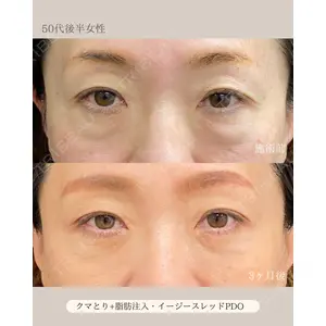 自由が丘ウェルエイジングビューティークリニック 福田 知佐子医師の症例