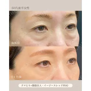 自由が丘ウェルエイジングビューティークリニック 福田 知佐子医師の症例