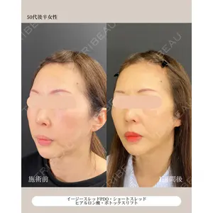 自由が丘ウェルエイジングビューティークリニック 福田 知佐子医師の症例