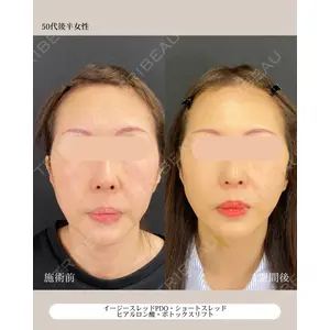 自由が丘ウェルエイジングビューティークリニック 福田 知佐子医師の症例
