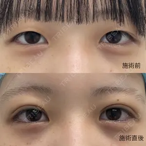 おおたかの森ビューティークリニックthe artの症例