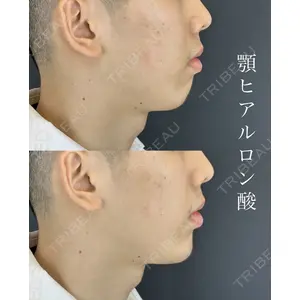 ルラ美容クリニック 広島院 角南 亮輔医師の症例