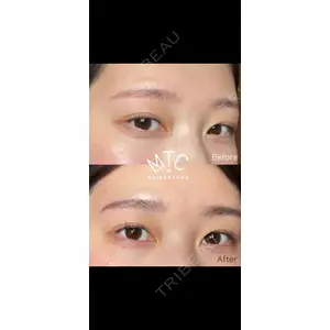 MTC美容皮膚科クリニック 代官山  美春医師の症例