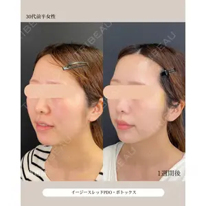 自由が丘ウェルエイジングビューティークリニック 福田 知佐子医師の症例