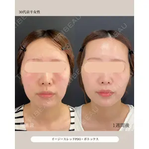 自由が丘ウェルエイジングビューティークリニック 福田 知佐子医師の症例