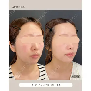 自由が丘ウェルエイジングビューティークリニック 福田 知佐子医師の症例