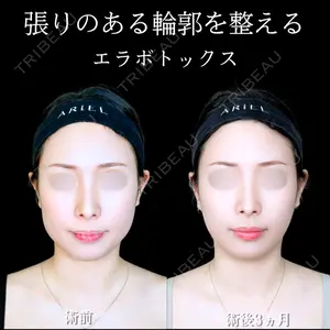 アリエル美容クリニック 大宮院 江郷隼一郎医師の症例