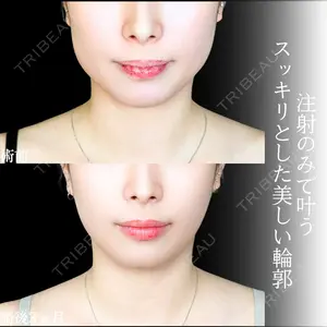 アリエル美容クリニック 大宮院 江郷隼一郎医師の症例