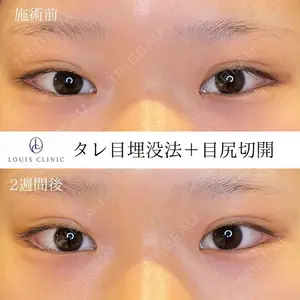LOUIS CLINIC 二子玉川院【ルイクリニック】 小松 塁医師の症例