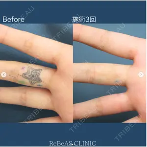 ReBeAS CLINICの症例