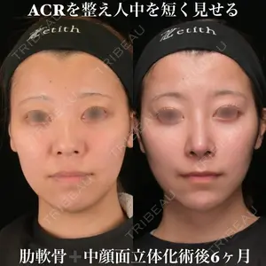 Zetith Beauty Clinic 銀座院 鉄 鑠医師の症例