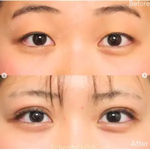 ReBeAS CLINICの症例