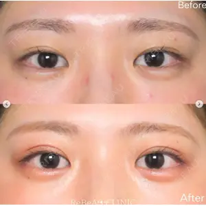 ReBeAS CLINICの症例