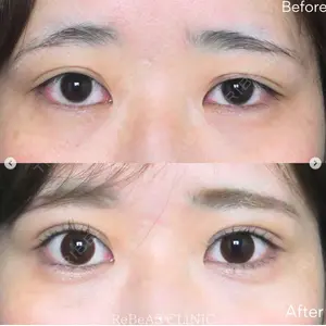 ReBeAS CLINICの症例